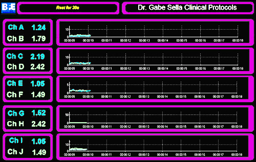 CLINICAL SEMG PROTOCOLS ELBOW - DR. SELLA - SUITE